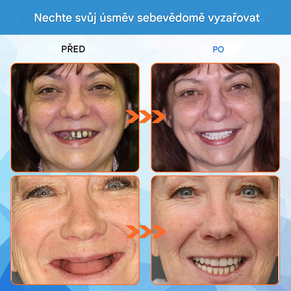 Zubní lékaři důrazně doporučují – keramické zubní náhrady pro seniory（AQY）